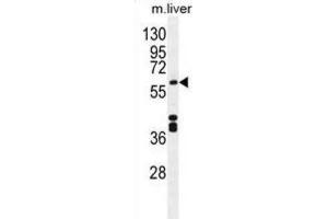 Western Blotting (WB) image for anti-Cytochrome P450, Family 1, Subfamily A, Polypeptide 2 (CYP1A2) antibody (ABIN2996139) (CYP1A2 抗体)