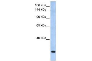 FBXW10 antibody used at 1 ug/ml to detect target protein. (FBXW10 抗体  (Middle Region))