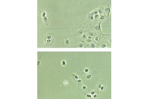 Immunohistochemistry. (NF-kB p65 抗体  (N-Term, NLS Domain))
