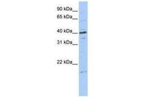 Image no. 1 for anti-Tubulin Polymerization-Promoting Protein Family Member 3 (TPPP3) (C-Term) antibody (ABIN6740766) (TPPP3 抗体  (C-Term))