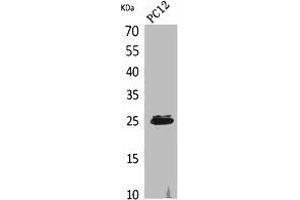 Western Blot analysis of PC12 cells using CMTM5 Polyclonal Antibody. (CMTM5 抗体  (N-Term))