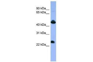Western Blot showing OPN1MW antibody used at a concentration of 1-2 ug/ml to detect its target protein. (OPN1MW 抗体  (C-Term))