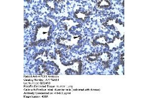 Immunohistochemistry (IHC) image for anti-Apurinic/Apyrimidinic Endonuclease 1 (APEX1) (N-Term) antibody (ABIN2779778)