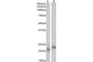 ABIN1590015 (2 µg/mL) staining of Mouse (A) and Rat (B) Spleen lysates (35 µg protein in RIPA buffer). (PYCARD 抗体  (Internal Region))