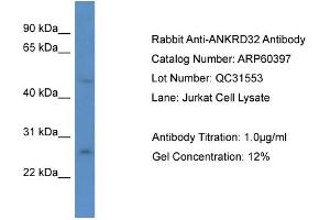 Western Blotting (WB) image for anti-Ankyrin Repeat Domain 32 (ANKRD32) (N-Term) antibody (ABIN2774286) (ANKRD32 抗体  (N-Term))