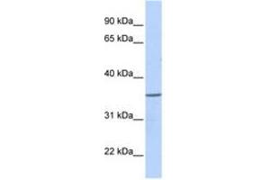 Image no. 1 for anti-Zinc Finger Protein 688 (ZNF688) (AA 108-157) antibody (ABIN6740519) (ZNF688 抗体  (AA 108-157))