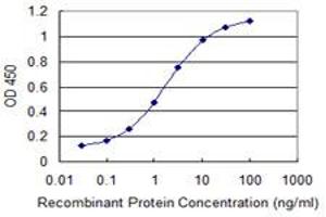 Detection limit for recombinant GST tagged CTNNBIP1 is 0. (CTNNBIP1 抗体  (AA 1-81))