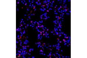 Immunofluorescence of paraffin embedded mouse lung using NSFL1C (ABIN7074865) at dilution of 1:650 (400x lens) (NSFL1C 抗体)