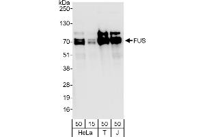 Western Blotting (WB) image for anti-Fused in Sarcoma (FUS) (C-Term) antibody (ABIN7453401) (FUS 抗体  (C-Term))