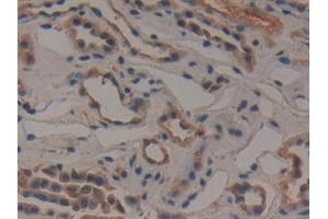 Detection of GCLM in Human Kidney Tissue using Polyclonal Antibody to Glutamate Cysteine Ligase, Modifier Subunit (GCLM) (GCLM 抗体  (AA 40-251))