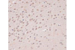 Immunohistochemistry of paraffin-embedded Mouse brain using PRPF31 Polyclonal Antibody at dilution of 1:100 (40x lens). (PRPF31 抗体)