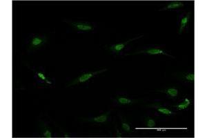 Immunofluorescence of monoclonal antibody to RAX on HeLa cell. (RAX 抗体  (AA 253-346))