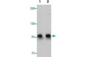 Western blot analysis of rat brain tissue with DCLK2 polyclonal antibody  at (Lane 1) 1 and (Lane 2) 2 ug/mL dilution. (DCLK2 抗体  (C-Term))