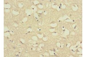 Immunohistochemistry of paraffin-embedded human brain tissue using ABIN7175065 at dilution of 1:100 (C11orf1 抗体  (AA 33-150))