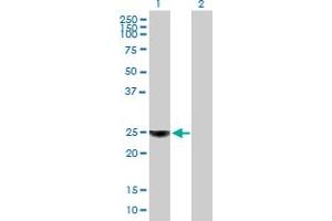 Western Blot analysis of ORM1 expression in transfected 293T cell line by ORM1 MaxPab polyclonal antibody. (ORM1 抗体  (AA 1-201))