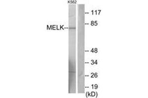 Western blot analysis of extracts from K562 cells, using MELK Antibody. (MELK 抗体  (AA 431-480))