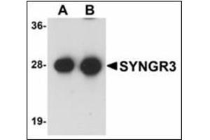 Western blot analysis of SYNGR3 in mouse brain tissue lysate with SYNGR3 antibody at (A) 1 and (B) 2 µg/ml . (Synaptogyrin 3 抗体  (C-Term))