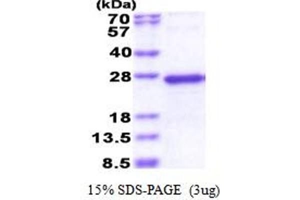 NDUFS5 Protein (AA 1-106) (His tag)