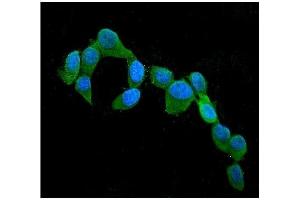 IF analysis of CST3 using anti-CST3 antibody (ABIN6719299). (CST3 抗体  (AA 31-146))