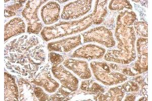 IHC-P Image CYP24A1 antibody detects CYP24A1 protein at cytosol on mouse kidney by immunohistochemical analysis. (CYP24A1 抗体  (Center))