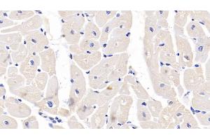 Immunohistochemistry (IHC) image for anti-Calreticulin (CALR) (AA 18-193) antibody (ABIN7433687)