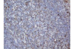 Image no. 1 for anti-Palmitoyl-Protein Thioesterase 1 (PPT1) (AA 100-306) antibody (ABIN1490802) (PPT1 抗体  (AA 100-306))