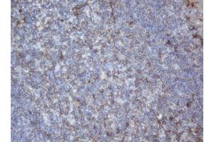 Image no. 1 for anti-Palmitoyl-Protein Thioesterase 1 (PPT1) (AA 100-306) antibody (ABIN1490802) (PPT1 抗体  (AA 100-306))