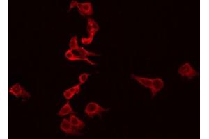 ABIN6272293 staining SKOV3 by IF/ICC. (Ephrin B3 抗体  (Internal Region))