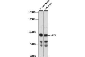 Western blot analysis of extracts of various cell lines, using NEK4 antibody (ABIN7268917) at 1:1000 dilution. (NEK4 抗体  (AA 1-300))