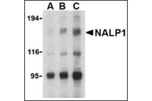 Western blot analysis of NALP1 in U937 cell lysate with this product at (A) 1, (B) 2 and (C) 4 μg/ml. (NLRP1 抗体  (C-Term))
