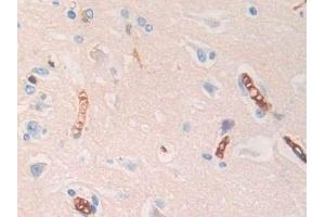 Immunohistochemistry (IHC) image for anti-Hemoglobin, delta (HBd) (AA 1-143) antibody (ABIN7443527)
