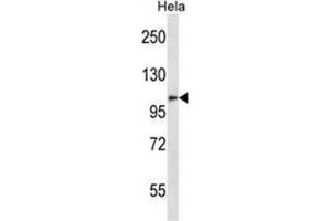 Western Blotting (WB) image for anti-Zinc Finger Protein, FOG Family Member 2 (ZFPM2) (AA 882-911), (C-Term) antibody (ABIN955663)