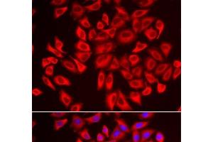 Immunofluorescence analysis of U2OS cells using DCAF7 Polyclonal Antibody