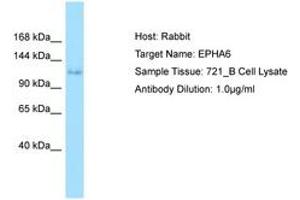 Image no. 1 for anti-EPH Receptor A6 (Epha6) (AA 313-362) antibody (ABIN6749998) (EPH Receptor A6 抗体  (AA 313-362))