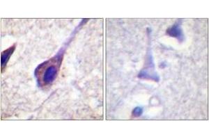 Immunohistochemistry analysis of paraffin-embedded human brain, using BID (Ab-78) Antibody.