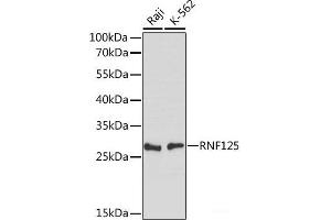 Western blot analysis of extracts of various cell lines using RNF125 Polyclonal Antibody at dilution of 1:1000. (RNF125 抗体)