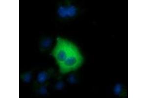 Anti-SDR9C7 mouse monoclonal antibody (ABIN2453633) immunofluorescent staining of COS7 cells transiently transfected by pCMV6-ENTRY SDR9C7 (RC210941). (SDR9C7 抗体)