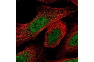 Immunofluorescent staining of human cell line U-2 OS shows positivity in nucleus but not nucleoli. (RPP25 抗体)