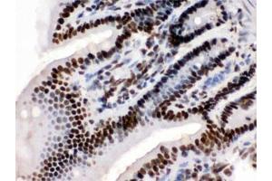 IHC testing of FFPE mouse intestine with TRIM28 antibody. (KAP1 抗体  (AA 699-835))
