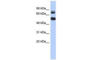 Image no. 1 for anti-Serine/threonine-Protein Kinase NIM1 (NIM1) (AA 143-192) antibody (ABIN6741236) (NIM1 抗体  (AA 143-192))