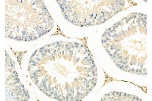 ABIN6264389 and ABIN6279692 at 1/100 staining Rat testis tissue by IHC-P. (PPP1R3D 抗体  (Internal Region))