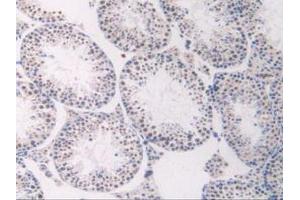 IHC-P analysis of Mouse Testis Tissue, with DAB staining. (FLT1 抗体  (AA 27-329))
