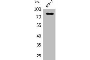 Western Blot analysis of MCF7 cells using IL-1RI Polyclonal Antibody (IL1R1 抗体  (N-Term))