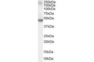 Image no. 1 for anti-Retinoic Acid Receptor, alpha (RARA) (C-Term) antibody (ABIN374531) (Retinoic Acid Receptor alpha 抗体  (C-Term))