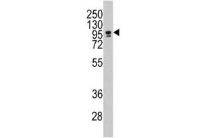 Western blot analysis of CEBPZ / CBF antibody and NCI-H460 lysate. (CEBPZ 抗体  (AA 1001-1029))