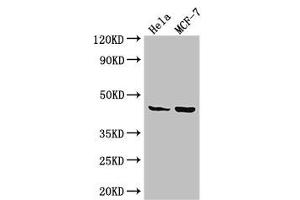 Western Blot Positive WB detected in: Hela whole cell lysate, MCF-7 whole cell lysate All lanes: MAP2K4 antibody at 3. (MAP2K4 抗体  (AA 259-398))