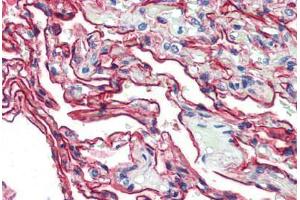Human Lung (formalin-fixed, paraffin-embedded) stained with S100A10 antibody ABIN462133 followed by biotinylated anti-mouse IgG secondary antibody ABIN481714, alkaline phosphatase-streptavidin and chromogen. (S100A10 抗体)