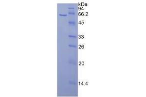 SDS-PAGE analysis of Mouse Calbindin Protein. (CALB1 蛋白)