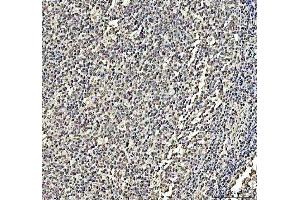 IHC analysis of DCK using anti-DCK antibody (ABIN5693016).
