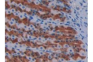 Detection of FGF1 in Rat Stomach Tissue using Monoclonal Antibody to Fibroblast Growth Factor 1, Acidic (FGF1) (FGF1 抗体  (AA 16-155))
